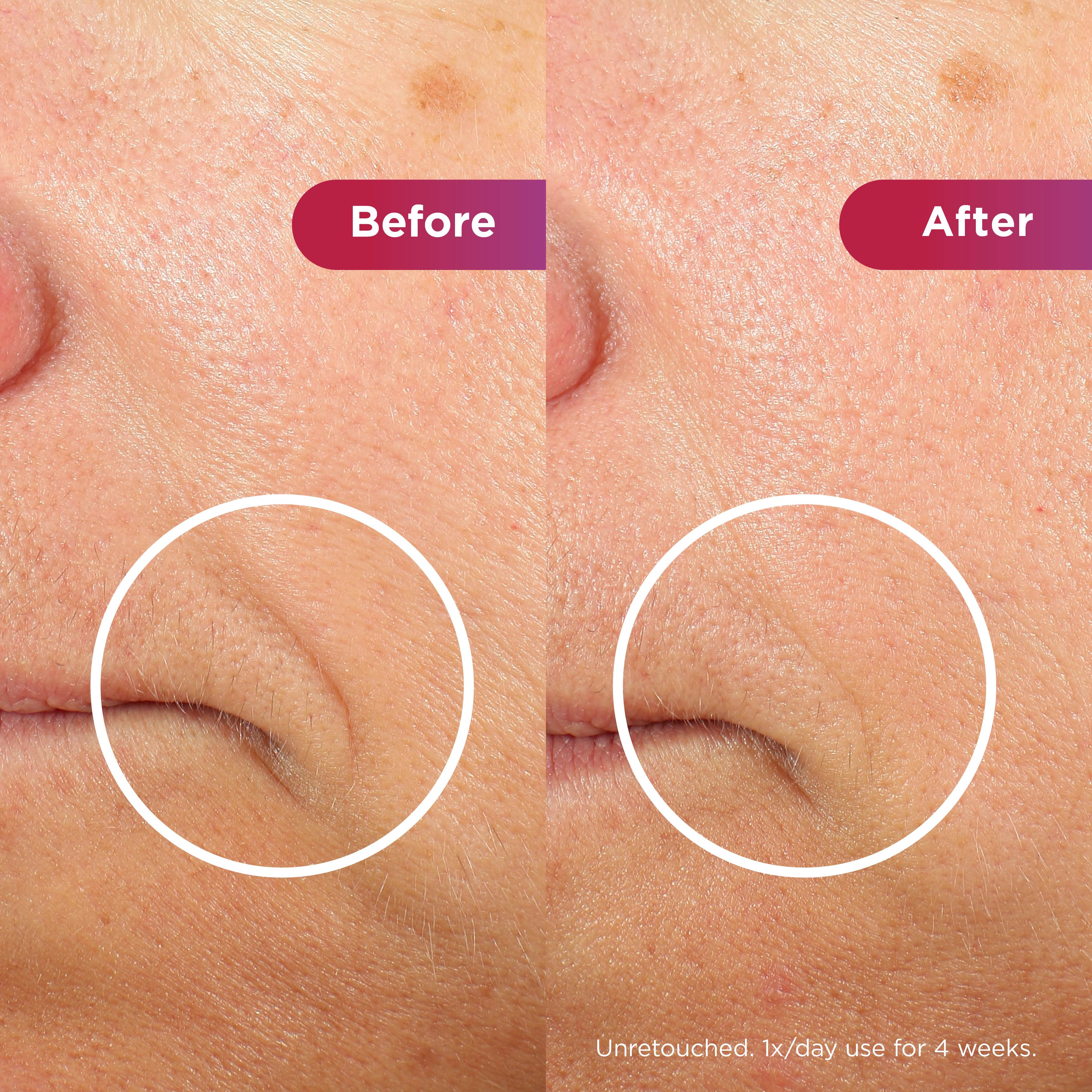 Skin firmness results