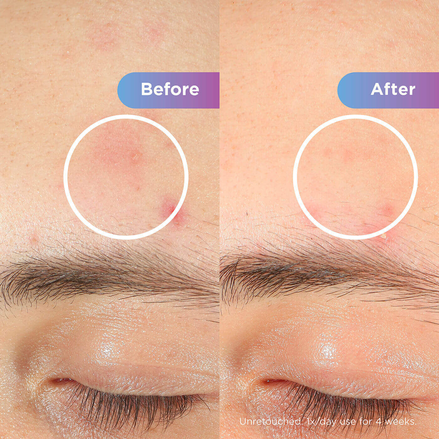 Blemish repair results