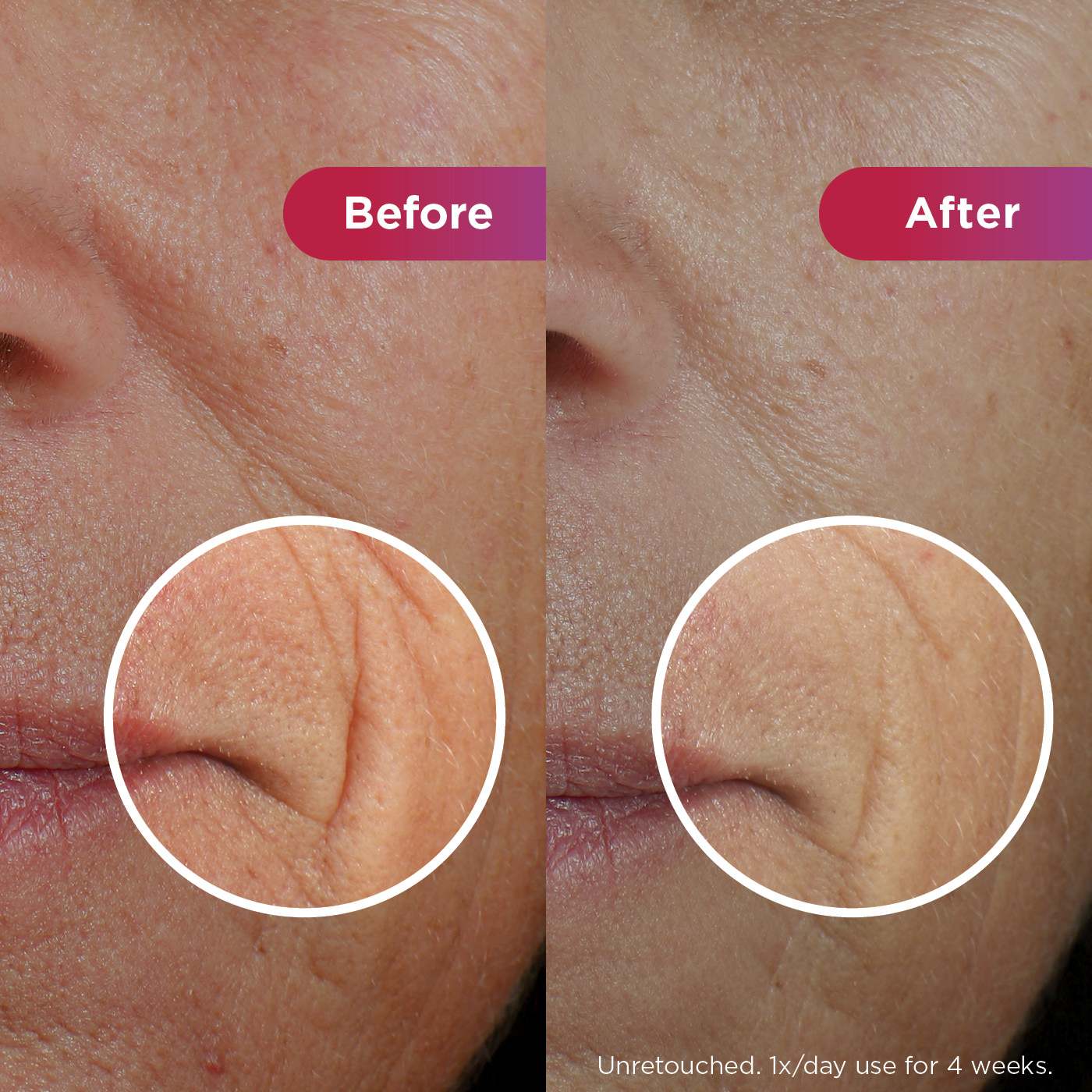 Better ageing results