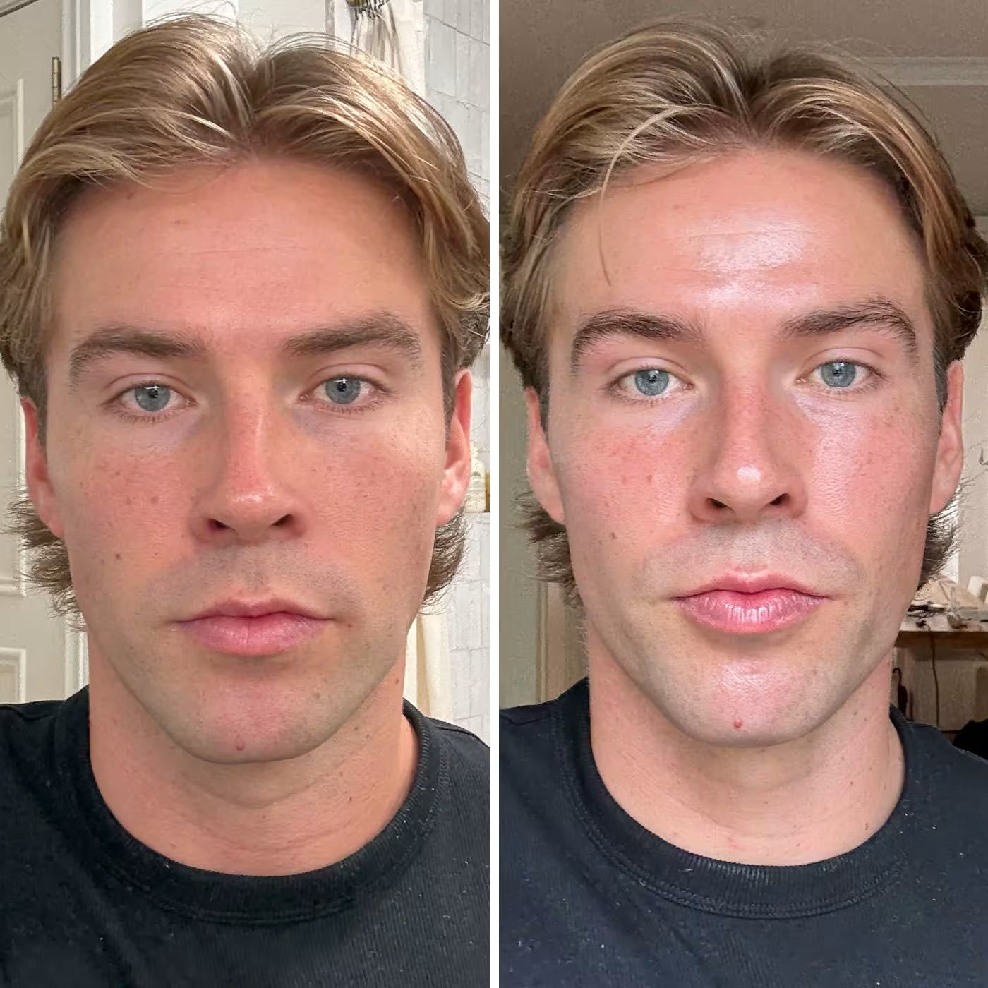 Before and after first use